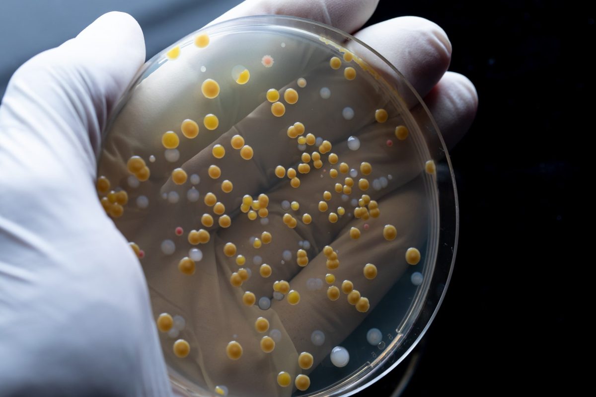 Eine Person mit einem weißen Handschuh hält eine bunte Bakterienkolonie in einer Petrischale.